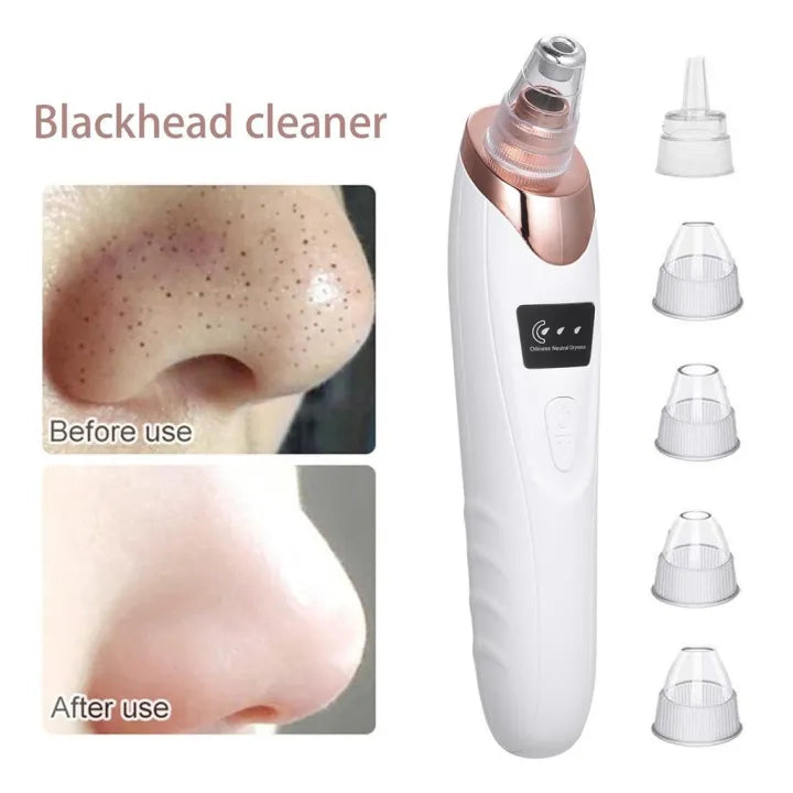 Multifunctional Electric Blackhead Remover